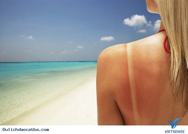 Cách chữa rộp da Cách chữa rộp da